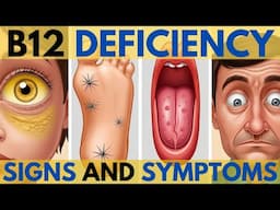 Top Vitamin B12 Deficiency Signs: Are Diabetics At Higher Risk?