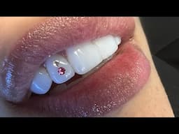 How to apply tooth gems