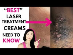 BEST LASER TREATMENT CREAM #goseechristy