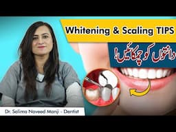 Teeth Whitening & Polishing | Danto Ki Scaling Kaise Hoti Hai | Scaling & Polishing Tips