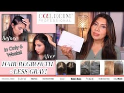 Calecim Advanced Hair System Gets REAL Results in 6 Weeks!