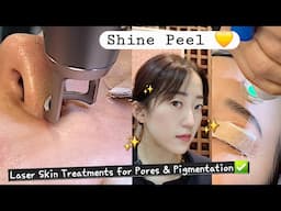 My Favorite Laser Treatment for my Big Pores ft. Shine Peel with Erbium Laser