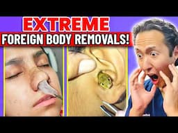 Doctor Reacts to EXTREME & SATISFYING Foreign Body Removals!