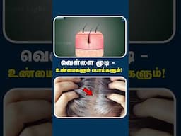 ஒரு வெள்ளை முடிய புடுங்குனா நெறையா வெள்ளை முடி வருமா? | Myths & truths about white hair!