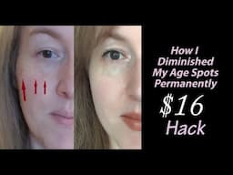 I Diminished Age Spots with $16 Hack vs $300 Treatment | Anti-Aging Dark Spot Removal | Compound W