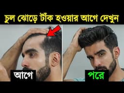 চুল পরা থামিয়ে নতুন চুল গজানোর উপায় | Notun Chul Gojanor Ghoroa Upay | Success Never End