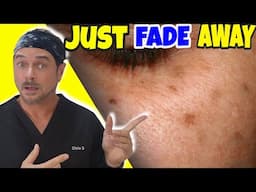 Like MAGIC For Removing Dark Spots & Patches | Chris Gibson