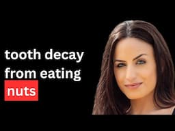 🔴 Tooth decay is due to eating nuts!