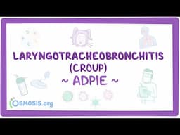 Laryngotracheobronchitis (LTB) & croup: Nursing Process (ADPIE)