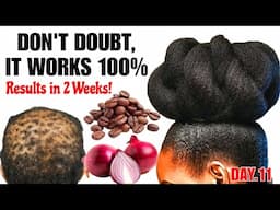 MIX ONION & COFFEE FOR EXTREME X10 FASTER HAIR GROWTH! Try it