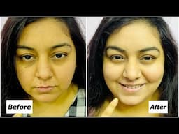 Dark Spot, Dark Circle remedy at Home | L'Oreal Paris Glycolic Bright Eye Serum | JSuper Kaur