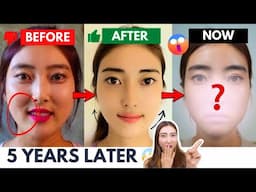 I am sorry… MY FACE IS CHANGING! 2 Weeks Smile Lines Challenge