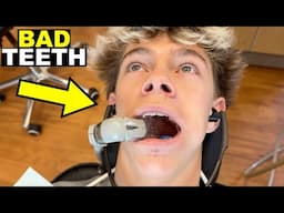 GETTING 12 CAVITIES FILLED AT THE DENTIST FROM EATING TOO MUCH FRUIT! 🦷🍉