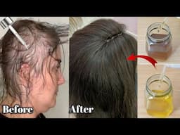 Japanese secret! put it on your hair for 2 weeks, and your hair will grow fast without stopping, hai