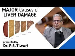 Major Causes of Liver Damage -- Dr P S Tiwari #homeopathy