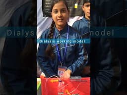 Dialysis working model | Science project for school | science model | #shorts