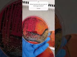 Bacteria on XLD Agar Plate #shorts #microbiology #chemistry #laboratory