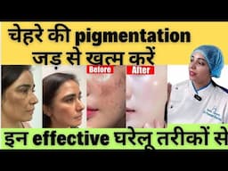 चेहरे की Pigmentation दूर करने के आसान और असरदार घरेलू उपाय | Skin Pigmentation At Home |