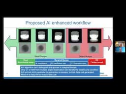 Using AI In Semiconductor Inspection