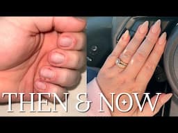 My Gel Nail Allergy Journey | Gel Nail Series