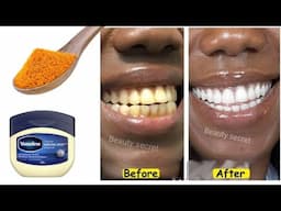 Teeth whitening and scaling at home in 1minute! Get white and shiny teeth like pearls.