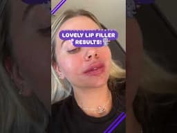 Lovely Lip Filler Results