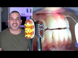 Gum Disease Periodontitis | Stop Bleeding Gums NOW!