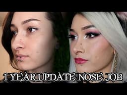 1 YEAR UPDATE NOSE JOB/ RHINOPLASTY | Scream Kiwi