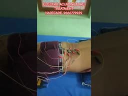 ELECTRO ACUPUNCTURE TREATMENTNADICARE 9666779929