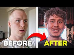 I Lost All My Hair, This is How I Fixed it!