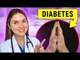 Top 10 Signs of DIABETES You Can SEE: Doctor Explains