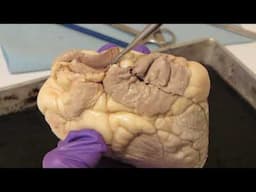 Heart Dissection: Sheep Heart  External Anatomy