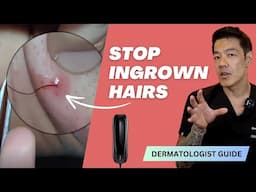 Stop Shaving and No More Ingrowns | IPL Laser Hair Removal at Home | Dr Davin Lim