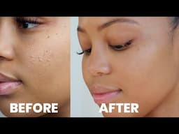 How I Got Rid of My Textured Skin + Improved My Skin