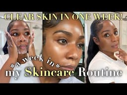 DO THIS EVERYDAY FOR CLEAR, GLOWY SKIN! | WEEKLY SKINCARE ROUTINE FOR ACNE, DARK SPOTS + GLASS SKIN