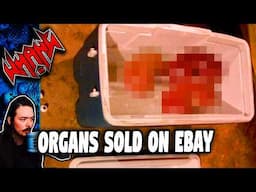 Body Parts Sold on eBay - Tales From the Internet