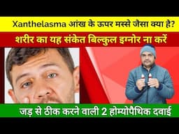 Xanthelasma आंख के ऊपर जमा फैट को हटाने वाली होम्योपैथिक दवा