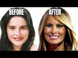 Melania Trump's Plastic Surgery Secrets Exposed (2024)