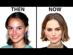 Natalie Portman's NEW FACE | Plastic Surgery Analysis