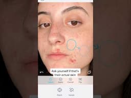 PROOF THAT SOCIAL MEDIA IS FAKE 😭 #realskintexture #acnepositivity #beautystandard #skincare