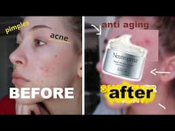 Neutrogena Rapid Wrinkle Repair Review !! *not sponsored* // retinol for acne.