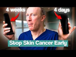 Prevent Squamous Cell Carcinoma (SCC): New 4-Day Treatment! (EFUDIX ALTERNATIVE)