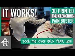 How I used 3D Printing to stop Bruxism, TMJ Face Pain, Clenching & Stomach Sleeping with a Switch