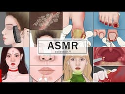 20 MINUTES Satisfying ASMR | Scalp Scaling,  Ingrown Toenail, Blackheads, Tonsil Stone Removal