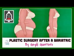 HOW SOON POST BARIATRIC SURGERY SHOULD I HAVE PLASTIC SURGERY? || Geydi Guerrero || Finer Beauty Spa