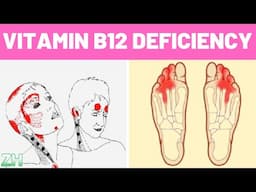 Vitamin B12 Deficiency Symptoms That Should Never Be Ignored