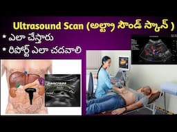 Ultrasound Scan Detailed Video in Telugu| అల్ట్రా సౌండ్ స్కాన్ ఎలా చేస్తారు