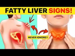 Never Ignore These 8 Early Signs of a Fatty Liver