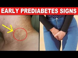 9 Early PREDIABETES Warning Signs You're Unaware Of