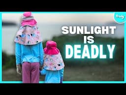 Sunlight Is Deadly To Our Two Daughters | MY EXTRAORDINARY FAMILY